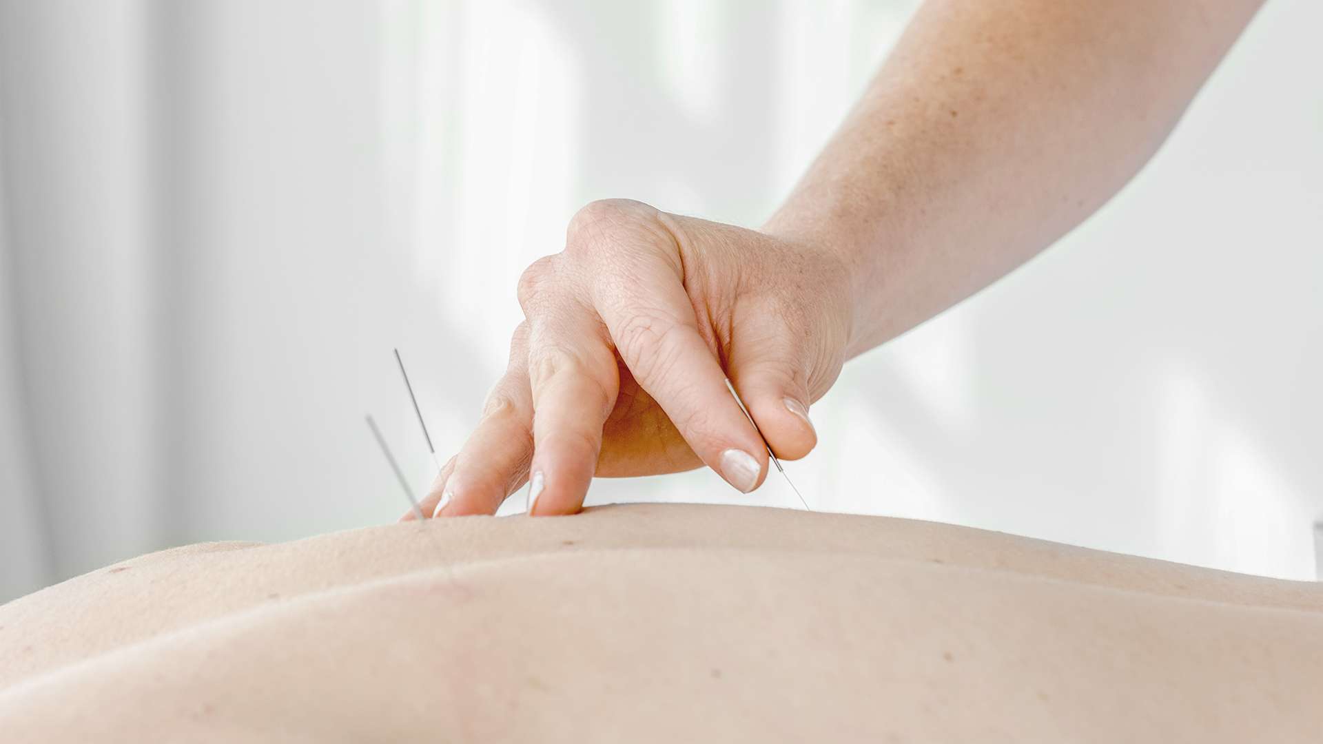 Acupuncture Therapy Needles-8208